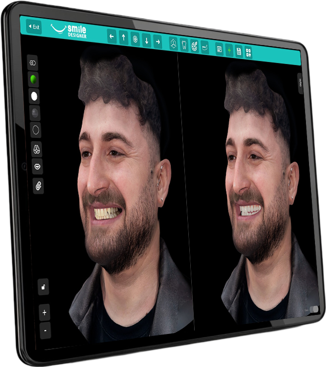 3D Smile Design